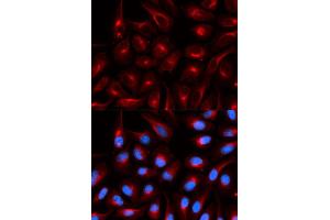 Immunofluorescence (IF) image for anti-Transducin-Like Enhancer of Split 1 (E(sp1) Homolog, Drosophila) (TLE1) antibody (ABIN1876687)