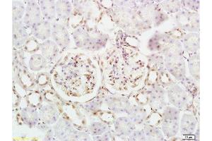 Formalin-fixed and mouse kidney tissue labeled with Anti-Defensin-beta2/DEFB2/HBD-2 Polyclonal Antibody, Unconjugated  at 1:200 followed by conjugation to the secondary antibody and DAB staining