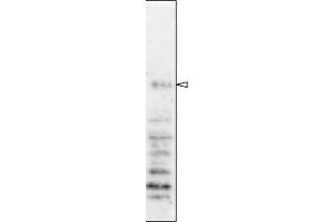 Western Blotting (WB) image for anti-Nucleoporin 98kDa (NUP98) (AA 1-466) antibody (ABIN2452066) (NUP98 anticorps  (AA 1-466))
