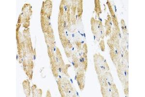 Immunohistochemistry of paraffin-embedded Rat heart using COPB2 Polyclonal Antibody at dilution of 1:100 (40x lens). (COPB2 anticorps)