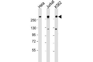 All lanes : Anti-CHD3 Antibody (N-Term) at 1:1000-1:2000 dilution Lane 1: Hela whole cell lysate Lane 2: Jurkat whole cell lysate Lane 3: K562 whole cell lysate Lysates/proteins at 20 μg per lane. (CHD3 anticorps  (AA 595-629))