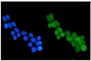 IF analysis of HDAC4 using anti-HDAC4 antibody (ABIN5518841).