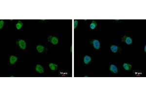 anti-Heterogeneous Nuclear Ribonucleoprotein A/B (HNRNPAB) antibody