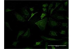 Immunofluorescence of monoclonal antibody to CASP10 on HeLa cell. (Caspase 10 anticorps  (AA 1-110))