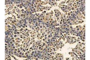 TBK1 Mouse Monoclonal Antibody at 1/100 staining mouse testis tissue by IHC-P. (TBK1 anticorps  (Internal Region))