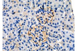 ABIN6257430 and ABIN6275339 at 1/100 staining Mouse kidney tissue by IHC-P.