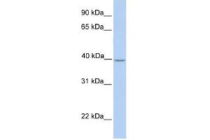 SAMSN1 antibody used at 1 ug/ml to detect target protein. (SAMSN1 anticorps  (Middle Region))