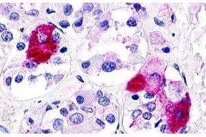 Image no. 2 for anti-G Protein-Coupled Receptor 21 (GPR21) (Transmembrane Domain) antibody (ABIN1048778)