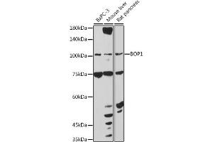 Western blot analysis of extracts of various cell lines, using BOP1 antibody (ABIN7265887) at 1:1000 dilution. (BOP1 anticorps  (AA 600-680))