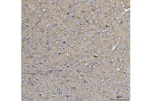 IHC analysis of CD90/Thy1 using anti-CD90/Thy1 antibody (ABIN5518877). (CD90 anticorps  (AA 20-131))