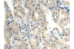 Detection of CALML3 in Human Stomach Tissue using Polyclonal Antibody to Calmodulin Like Protein 3 (CALML3) (CALML3 anticorps  (AA 1-149))