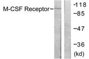 Western Blotting (WB) image for anti-Colony Stimulating Factor 1 Receptor (CSF1R) (AA 781-830) antibody (ABIN2888675) (CSF1R anticorps  (AA 781-830))