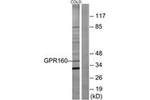 Western blot analysis of extracts from COLO205 cells, using GPR160 Antibody. (GPR160 anticorps  (AA 289-338))