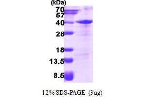 SDS-PAGE (SDS) image for Zinc Finger, AN1-Type Domain 3 (ZFAND3) (AA 1-227) protein (His tag) (ABIN668015)