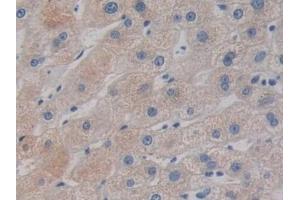 Detection of DCLK1 in Human Liver Tissue using Polyclonal Antibody to Doublecortin Like Kinase 1 (DCLK1)