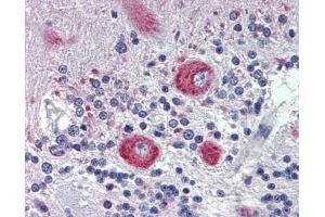 GRHL2 antibody was used for immunohistochemistry at a concentration of 4-8 ug/ml.