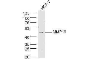 Human MCF-7 cell lysates probed with Rabbit Anti-MMP19 Polyclonal Antibody, Unconjugated  at 1:500 for 90 min at 37˚C. (MMP19 anticorps  (AA 251-350))