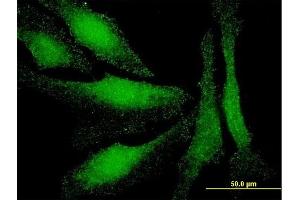 Immunofluorescence of monoclonal antibody to LMO3 on HeLa cell. (LMO3 anticorps  (AA 91-146))