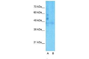 Host:  Rabbit  Target Name:  LSR  Sample Type:  Human Fetal Liver  Lane A:  Primary Antibody  Lane B:  Primary Antibody + Blocking Peptide  Primary Antibody Concentration:  1ug/ml  Peptide Concentration:  5ug/ml  Lysate Quantity:  25ug/lane/lane  Gel Concentration:  0. (LSR anticorps  (C-Term))