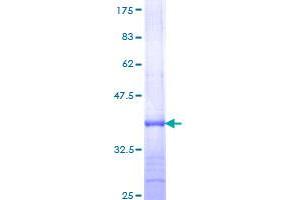 Image no. 1 for Elastase, Neutrophil Expressed (ELANE) (AA 168-267) protein (GST tag) (ABIN1352646)