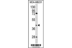 Western blot analysis of HOMER3 Antibody in MDA-MB231 cell line lysates (35ug/lane) (HOMER3 anticorps  (AA 281-308))