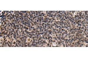 Immunohistochemistry of paraffin-embedded Human tonsil tissue using SIK3 Polyclonal Antibody at dilution of 1:60(x200) (SIK3 anticorps)