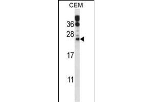 RAB6B Antibody (C-term) (ABIN657771 and ABIN2846747) western blot analysis in CEM cell line lysates (35 μg/lane). (RAB6B anticorps  (C-Term))