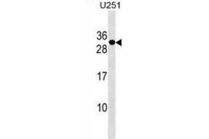 Western Blotting (WB) image for anti-POM121 and ZP3 Fusion (POMZP3) antibody (ABIN3000214) (POMZP3 anticorps)