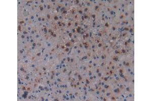 Used in DAB staining on fromalin fixed paraffin- embedded Kidney tissue (ACD anticorps  (AA 147-342))