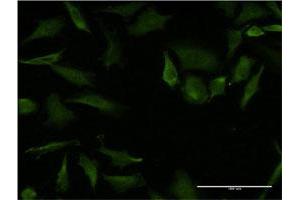 Immunofluorescence of monoclonal antibody to RHOA on HeLa cell. (RHOA anticorps  (AA 1-193))