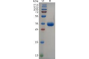 Human GRP Protein, hFc Tag on SDS-PAGE under reducing condition.