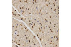 Immunohistochemistry of paraffin-embedded mouse heart using TriMethyl-Histone H4-K20 antibody.