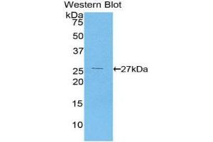 Western Blotting (WB) image for anti-Coagulation Factor XII (F12) (AA 400-615) antibody (ABIN3208108) (F12 anticorps  (AA 400-615))