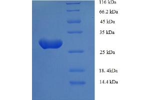 SDS-PAGE (SDS) image for Asialoglycoprotein Receptor 1 (ASGR1) (AA 68-291) protein (His tag) (ABIN4984149)