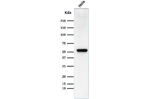 Western Blot Analysis of HeLa cell lysate using Fascin-1 Mouse Monoclonal Antibody (FSCN1/418)