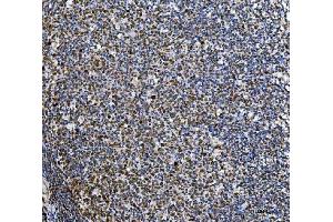 IHC analysis of Ki67/MKI67 using anti-Ki67/MKI67 antibody (ABIN7601873). (Ki-67 anticorps  (AA 5-2358))