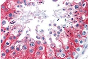 Human Testis: Formalin-Fixed, Paraffin-Embedded (FFPE)