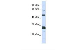 Image no. 1 for anti-Pescadillo Ribosomal Biogenesis Factor 1 (PES1) (C-Term) antibody (ABIN6739037) (PES1 anticorps  (C-Term))