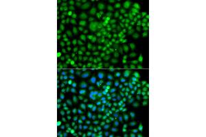 Immunofluorescence analysis of A549 cell using SUMO4 antibody. (SUMO4 anticorps)