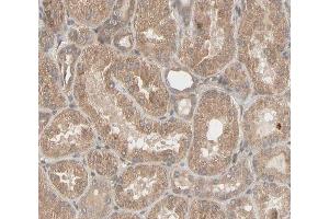 ABIN6266596 at 1/100 staining human kidney tissue sections by IHC-P.