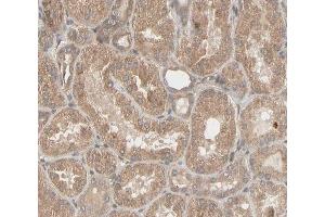 ABIN6266596 at 1/100 staining human kidney tissue sections by IHC-P. (MMP3 anticorps  (C-Term))