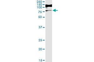 Immunoprecipitation of RIOK3 transfected lysate using anti-RIOK3 monoclonal antibody and Protein A Magnetic Bead , and immunoblotted with RIOK3 MaxPab rabbit polyclonal antibody.