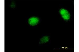Immunofluorescence of purified MaxPab antibody to POLH on HeLa cell. (POLH anticorps  (AA 1-713))