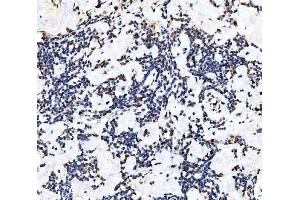 IHC analysis of KAT3B/P300/EP300 using anti-KAT3B/P300/EP300 antibody (ABIN7603064).