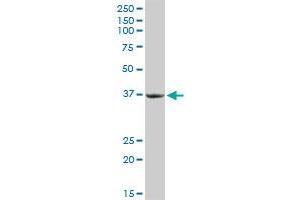 anti-Protein Kinase, Interferon-Inducible Double Stranded RNA Dependent Activator (PRKRA) (AA 1-313) antibody
