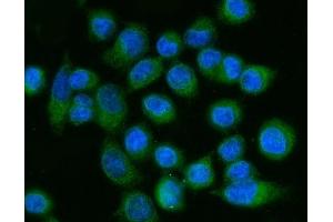 IF analysis of FACL4/ACSL4 using anti-FACL4/ACSL4 antibody (ABIN7602779).