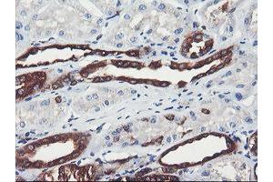 Image no. 1 for anti-phosphofructokinase, Platelet (PFKP) antibody (ABIN1500164)