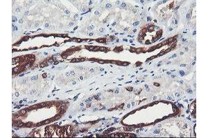 Image no. 1 for anti-phosphofructokinase, Platelet (PFKP) antibody (ABIN1500164) (PFKP anticorps)