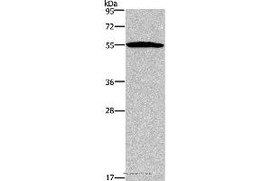 Western blot analysis of Human serum solution, using SERPINA1 Polyclonal Antibody at dilution of 1:250 (SERPINA1 anticorps)
