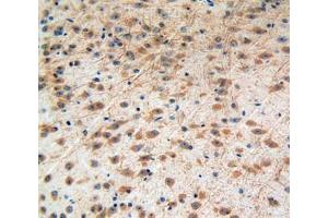 Used in DAB staining on fromalin fixed paraffin- embedded brain tissue